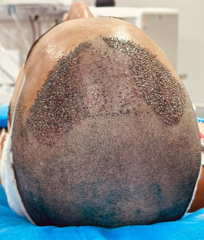 Érica Vilhena | Transplante Capilar| Queda Cabelo| São Paulo logo