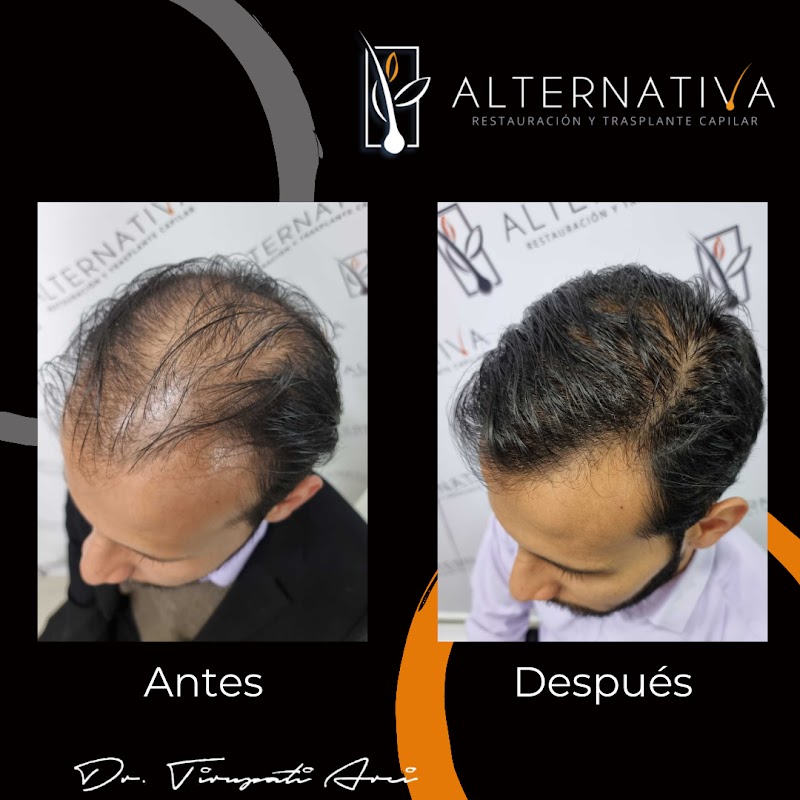 Alternativa Restauración Y Trasplante Capilar logo