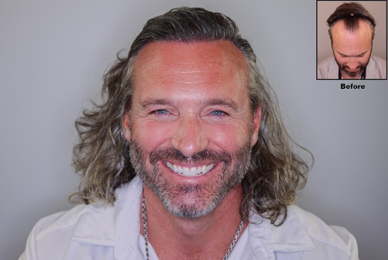 Alvi Armani - Beverly Hills logo