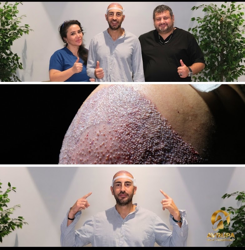 Avrupa Hair Transplant logo