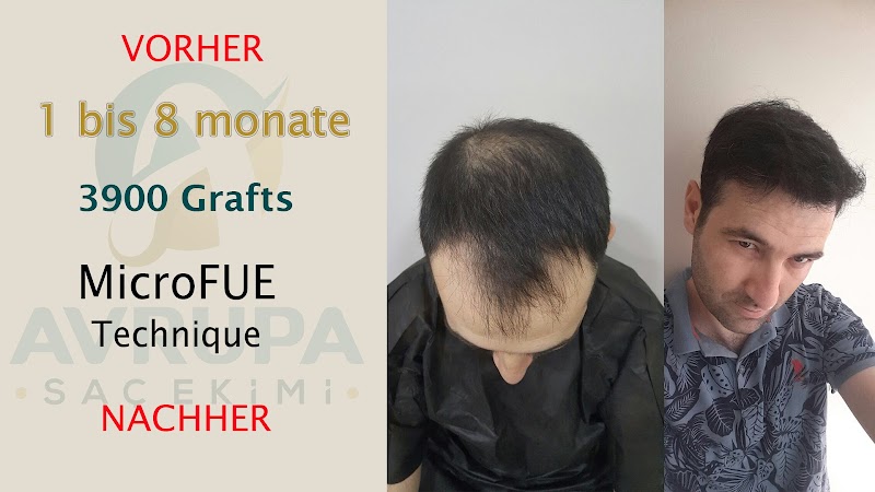 Avrupa Saç Ekimi logo