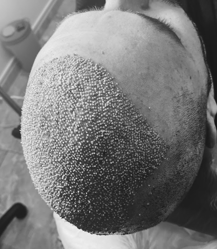 Eges Hair Clinic logo