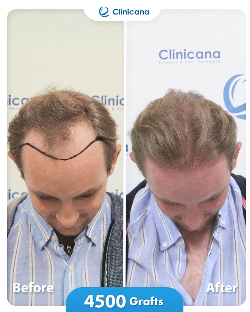 Clinicana Hair Transplant & Esthetic Surgeries logo