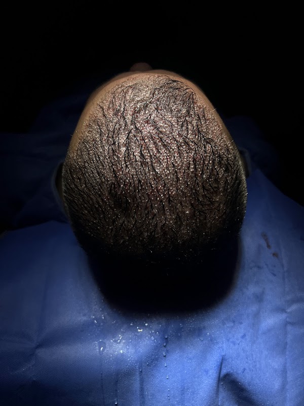 DHI Clinic Turkey -DHI Hair Transplant -Detail Hair Transplant logo