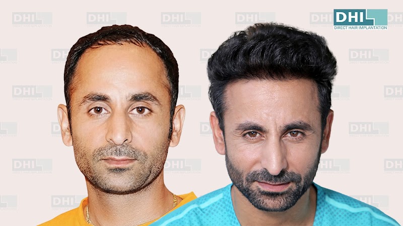 DHI India - Best Hair Transplant in Gurgaon logo