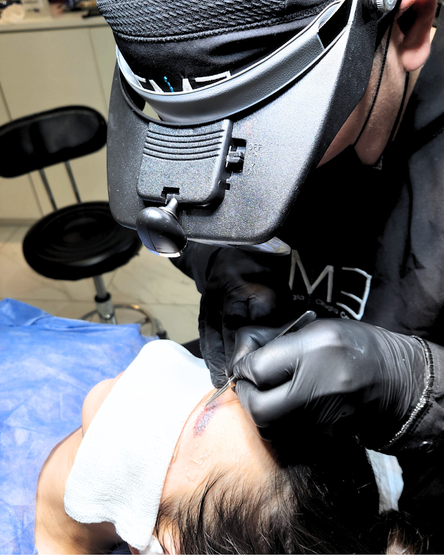 Dr. Edgar Meneses Implante Capilar logo