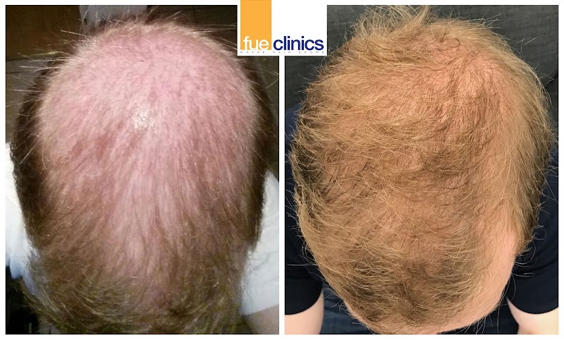 FUE Clinics - Manchester logo