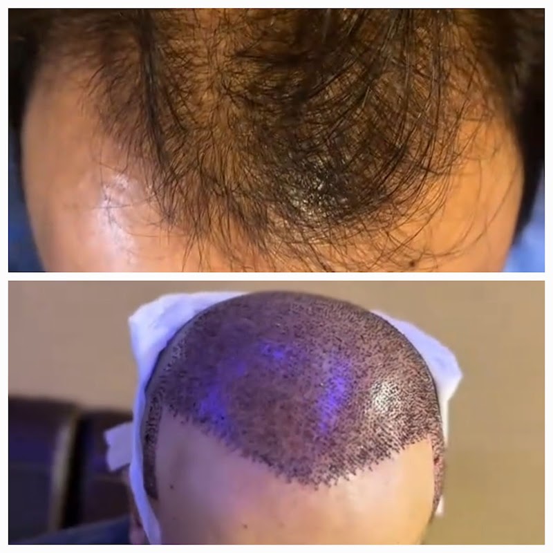 Glamorous Hair Transplant in Dubai | Glam Hair Clinic - FUE Hair Transplant Dubai, FUT Transplant, BioFibre, DHI logo