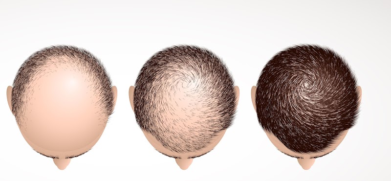 greffe cheveux tunisie logo