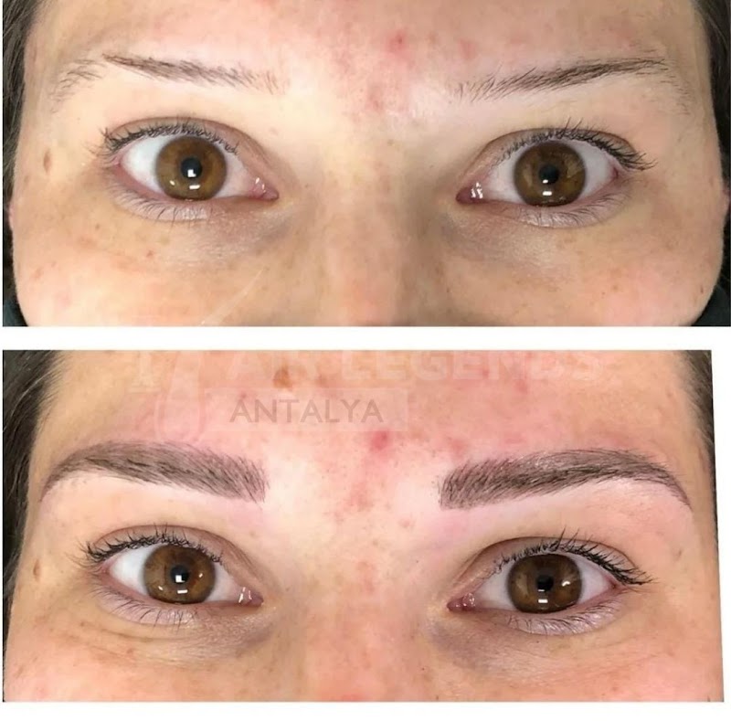 Hair Legends | Hair Transplant Antalya logo