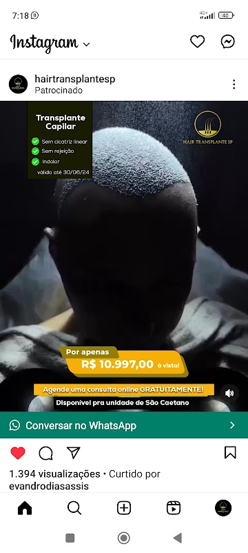 Hair Transplante Transplante capilar na zona sul de São Paulo logo