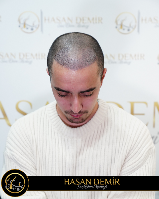 Hasan Demir Saç Ekimi Ankara logo