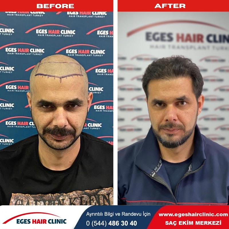İzmir Saç Ekim Merkezi | Eges Hair Clinic logo
