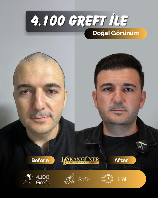 İzmir Saç Ekimi Merkezi - Hakan Güner logo