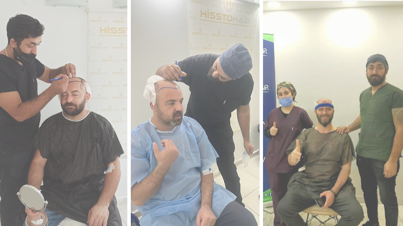 İzmir Saç Ekimi Merkezi - Hisstohair | Fue saç ekimi | PRP ve Mezoterapi | Sakal ekimi | Kaş ekimi logo