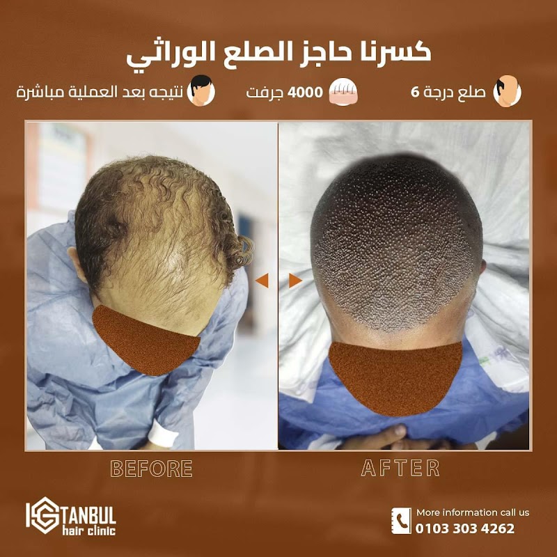 Istanbul Hair Clinic logo