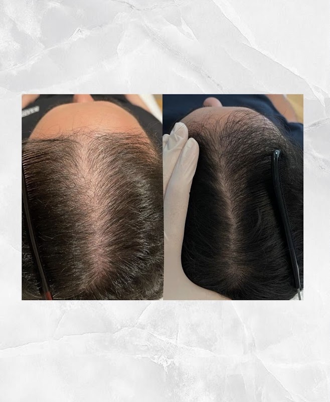 LEJOU DUBAI PRP HAIR logo