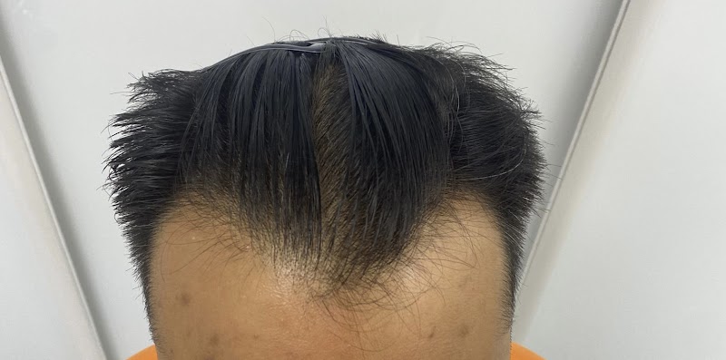 London Hair Transplant Clinic logo