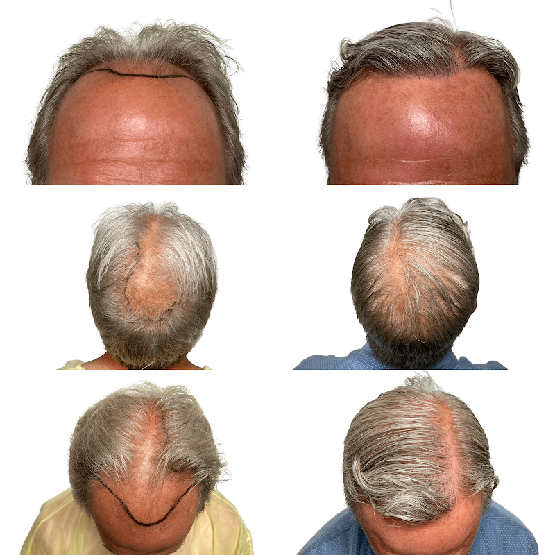 Maxim Hair Restoration & Transplants - New York City logo