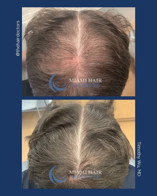 Miami Hair Institute logo