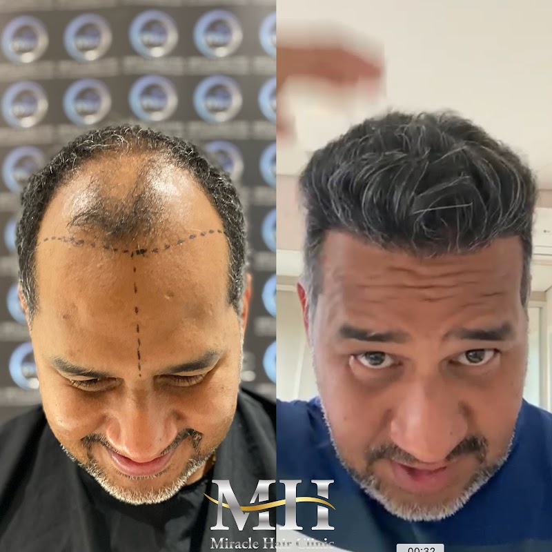 Miracle Hair Clinic Hair Transplant Turkey logo