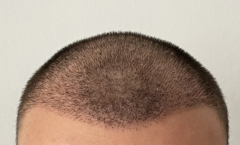 One Hair Clinic Transplantation - Plastic Esthetic logo