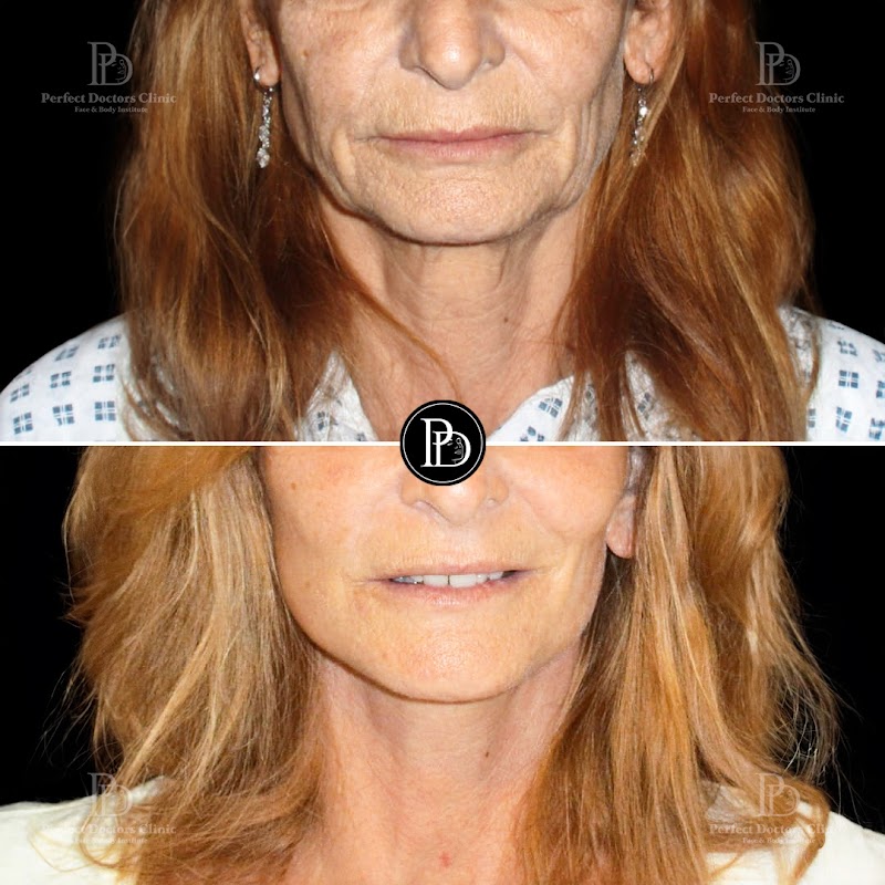 Perfect Doctors Clinic Dubai Rhinoplasty BBL Liposuction Gynecomastia tummy tuck facelift Breast body lift butt fillers botox logo