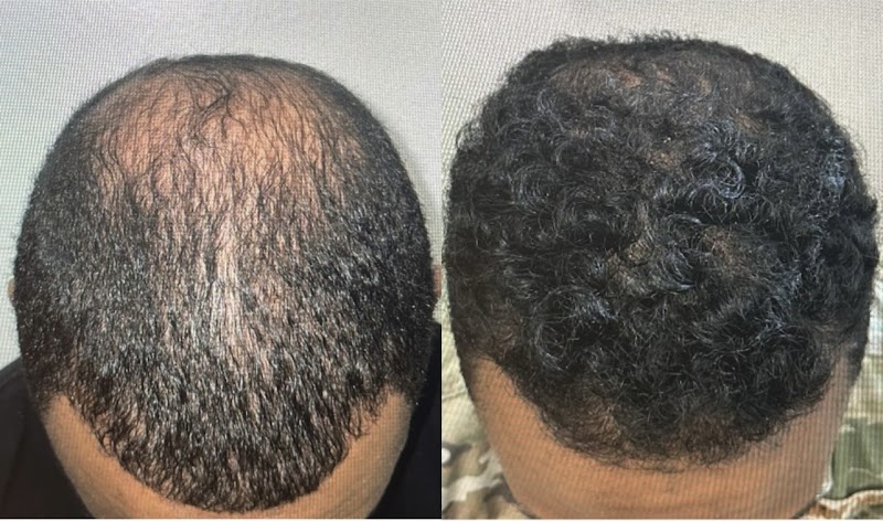 Revita Luxe Miami logo